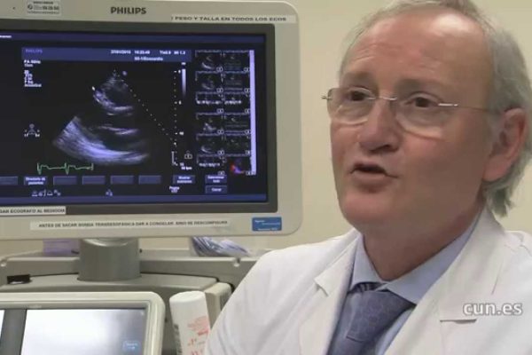 Los Beneficios del Ejercicio Cardiovascular para la Salud Ginecológica: Mejora Tu Bienestar