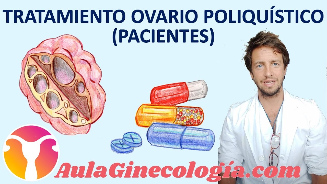 Como-manejar-el-sindrome-de-ovario-hiperluteinizado - Sonajero.es Cómo manejar el síndrome de ovario hiperluteinizado