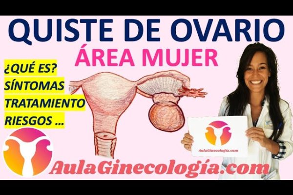 Cómo Manejar el Síndrome de Ovario Luteinizado Benigno: Guía Completa y Consejos Prácticos