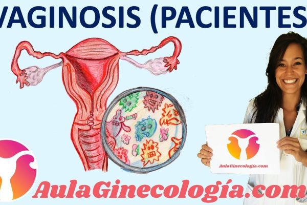 Cómo Identificar y Tratar la Vaginosis Bacteriana: Guía Completa para Mujeres