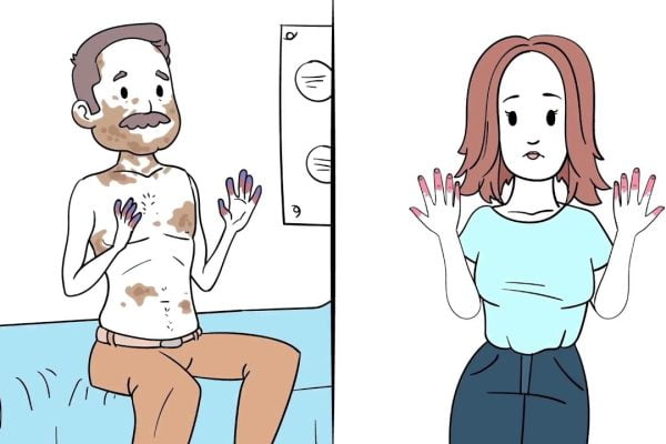 La Relación entre la Esclerodermia y la Salud Ginecológica: Lo que Debes Saber