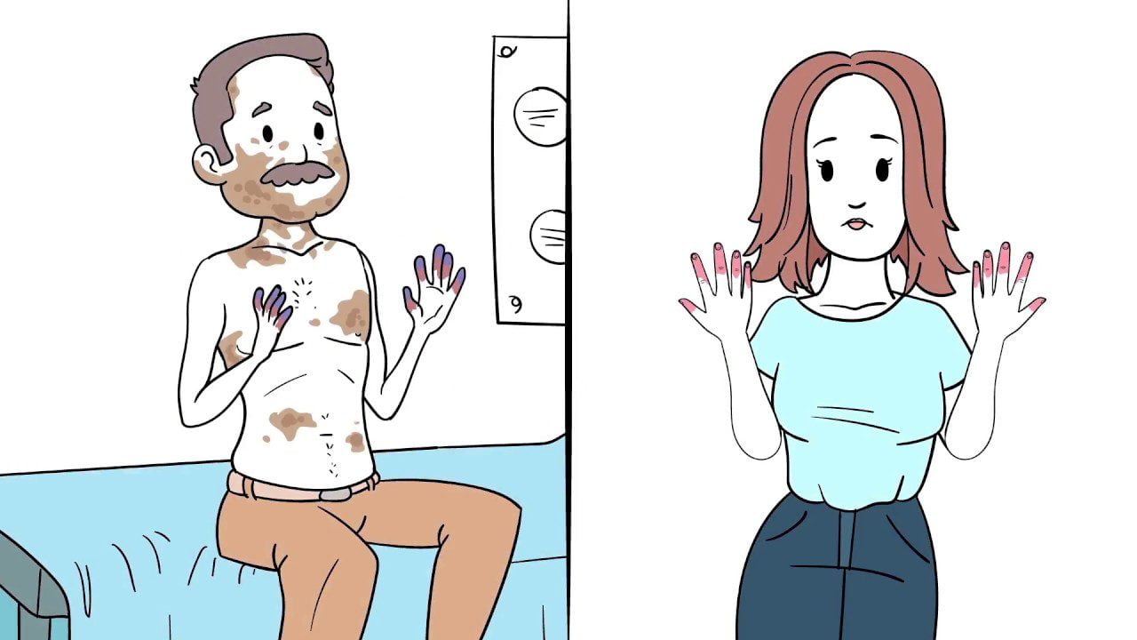 La-relacion-entre-la-esclerosis-sistemica-y-la-salud-ginecologica - Sonajero.es La relación entre la esclerosis sistémica y la salud ginecológica