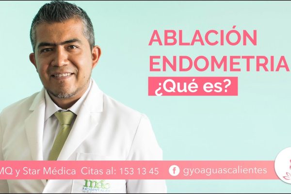 Guía completa sobre la ablación endometrial: Todo lo que debes saber