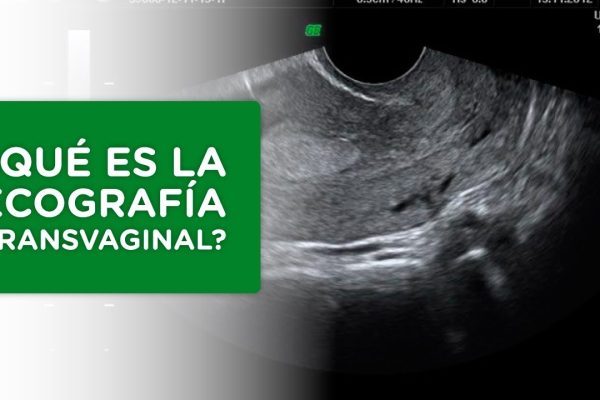 Guía completa sobre la ecografía ginecológica: ¡Descubre todo lo que necesitas saber!