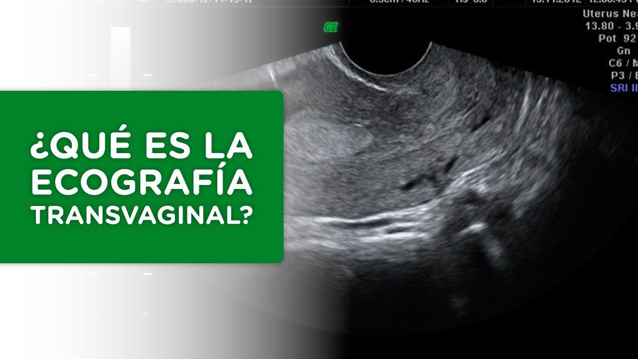 Todo-lo-que-necesitas-saber-sobre-la-ecografia-ginecologica - Sonajero.es Todo lo que necesitas saber sobre la ecografía ginecológica