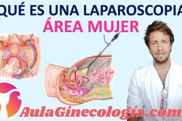Guía completa sobre la laparoscopia ginecológica: Todo lo que debes saber