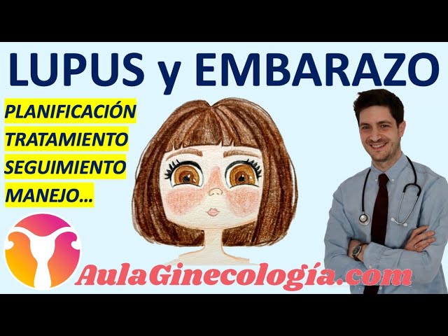 Todo-sobre-el-seguimiento-del-embarazo-con-lupus - Sonajero.es Todo sobre el seguimiento del embarazo con lupus