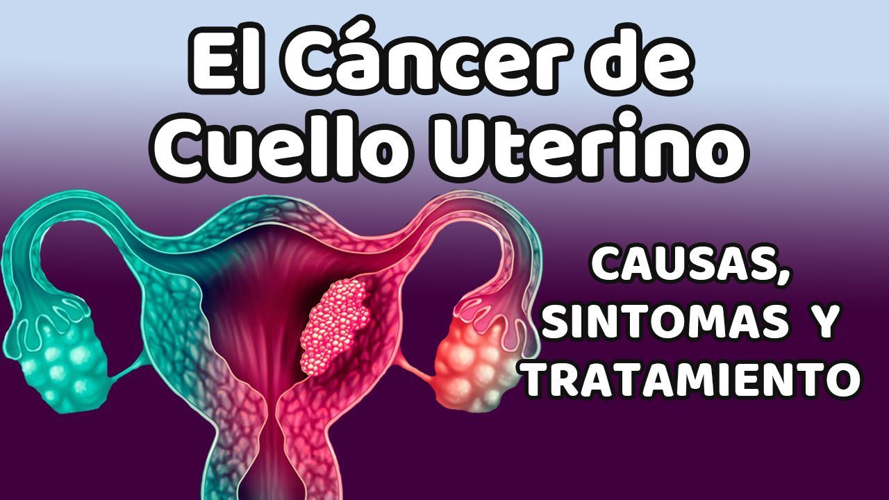La-relacion-entre-el-cancer-cervical-y-la-salud-ginecologica - Sonajero.es La relación entre el cáncer cervical y la salud ginecológica