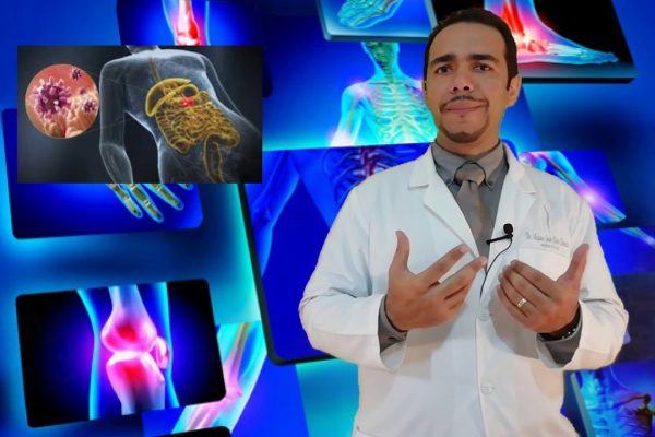 La Relación entre la Artritis Reactiva y la Salud Ginecológica: ¿Qué Debes Saber?