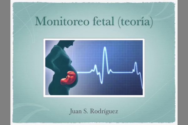 Todo lo que Necesitas Saber sobre el Monitoreo Fetal: Guía Completa y Actualizada