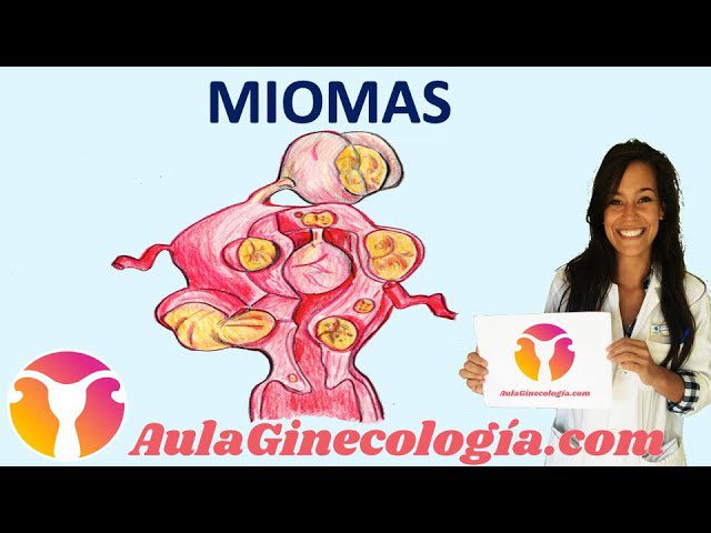 Todo-sobre-el-diagnostico-y-tratamiento-del-fibroma-uterino - Sonajero.es Todo sobre el diagnóstico y tratamiento del fibroma uterino