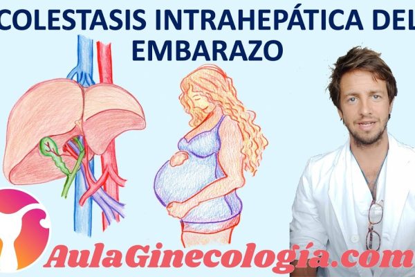 Todo sobre el Seguimiento del Embarazo con Insuficiencia Hepática: Guía Completa para Futuras Mamás