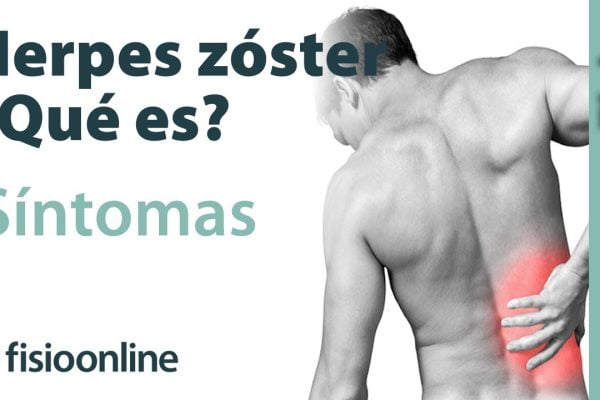 Cómo Prevenir y Tratar el Herpes Zóster Durante el Embarazo: Guía Completa
