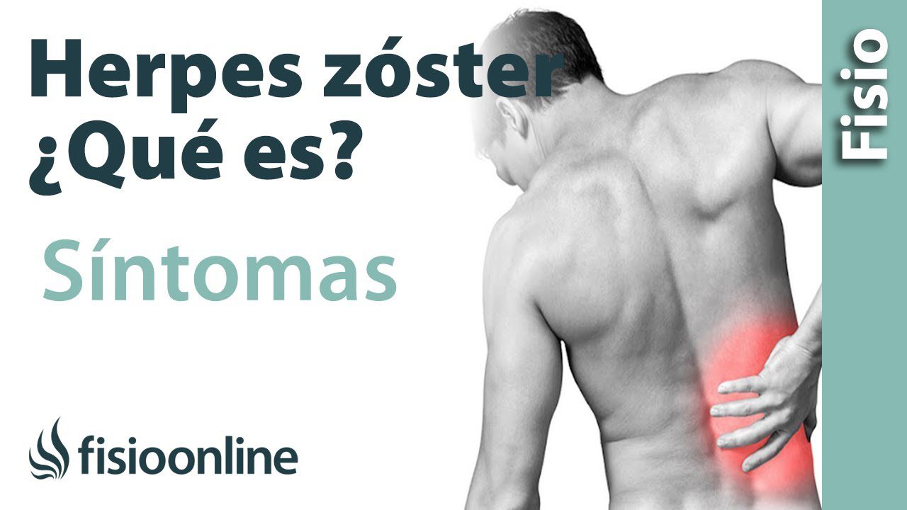 Como-prevenir-y-tratar-el-herpes-zoster-durante-el-embarazo - Sonajero.es Cómo prevenir y tratar el herpes zóster durante el embarazo