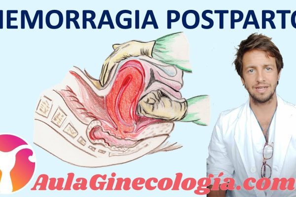 Cómo Prevenir y Tratar la Hemorragia Postparto: Guía Completa para Nuevas Madres