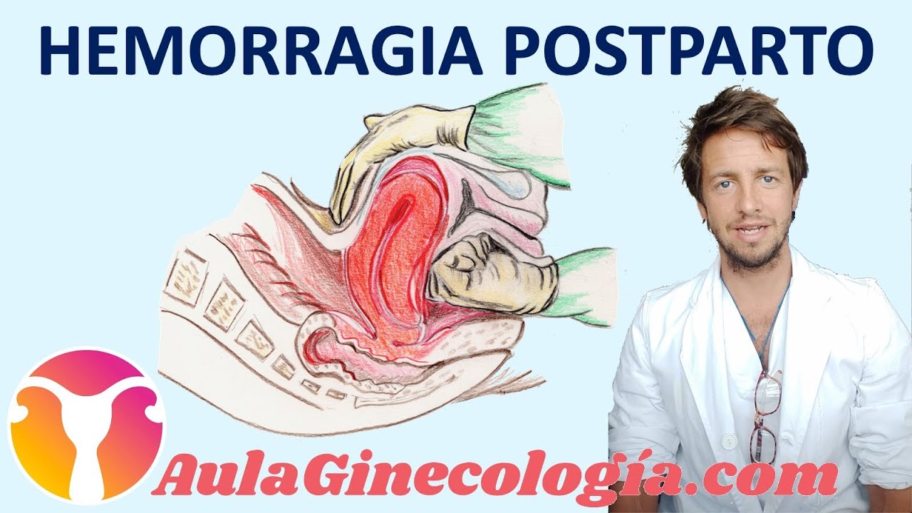 Como-prevenir-y-tratar-la-hemorragia-postparto - Sonajero.es Cómo prevenir y tratar la hemorragia postparto
