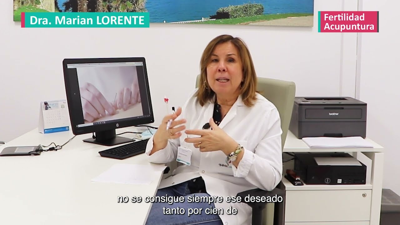 Los-beneficios-de-la-acupuntura-para-la-fertilidad - Sonajero.es Los beneficios de la acupuntura para la fertilidad