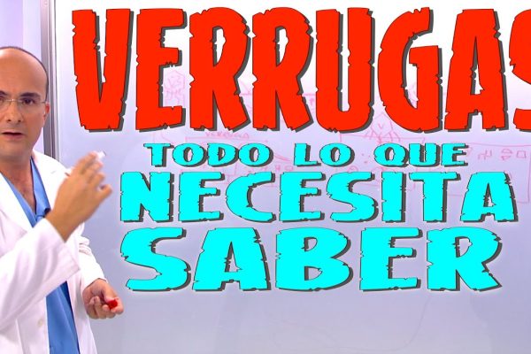 Todo lo que Necesitas Saber sobre la Eliminación de Verrugas Genitales: Métodos, Consejos y Prevención