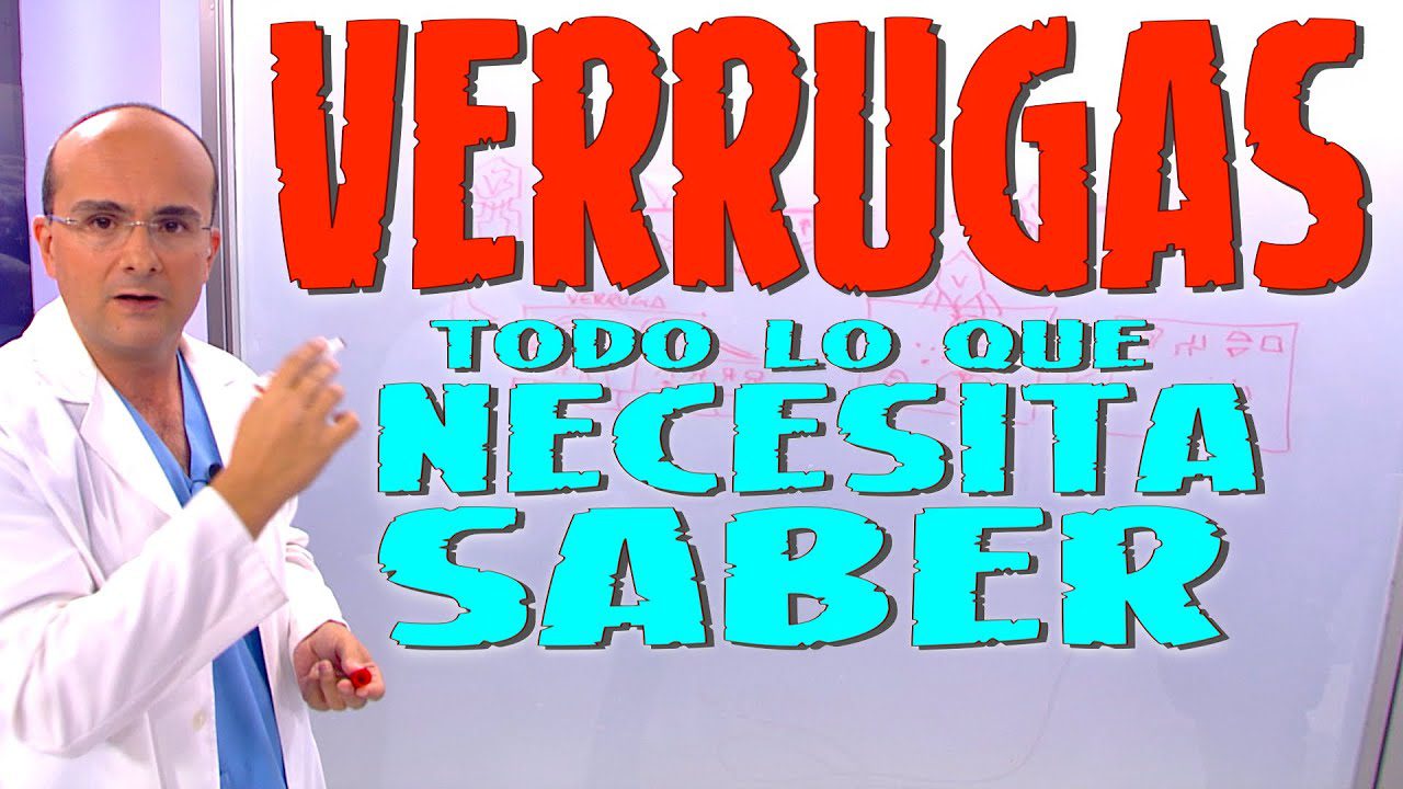 Todo-lo-que-necesitas-saber-sobre-la-eliminacion-de-verrugas-genitales - Sonajero.es Todo lo que necesitas saber sobre la eliminación de verrugas genitales