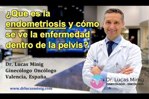 Extracción de Endometriomas: Todo lo Que Necesitas Saber