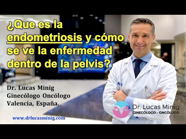 Todo-lo-que-necesitas-saber-sobre-la-extraccion-de-endometriomas - Sonajero.es Todo lo que necesitas saber sobre la extracción de endometriomas