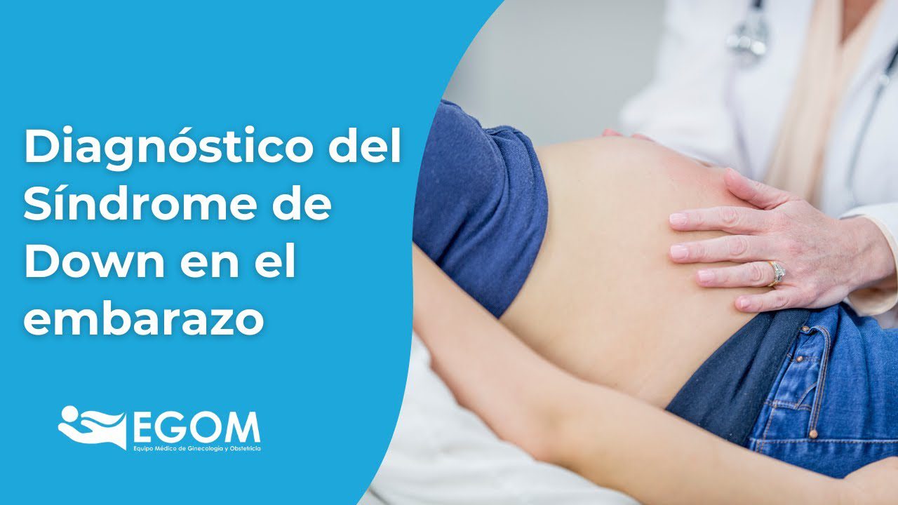 Todo-sobre-el-seguimiento-del-embarazo-con-sindrome-de-Down - Sonajero.es Todo sobre el seguimiento del embarazo con síndrome de Down