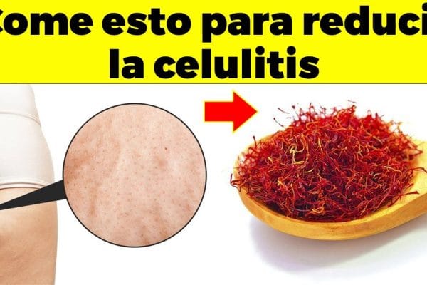 Alimentos que Ayudan a Combatir la Celulitis: Descubre los Mejores 10
