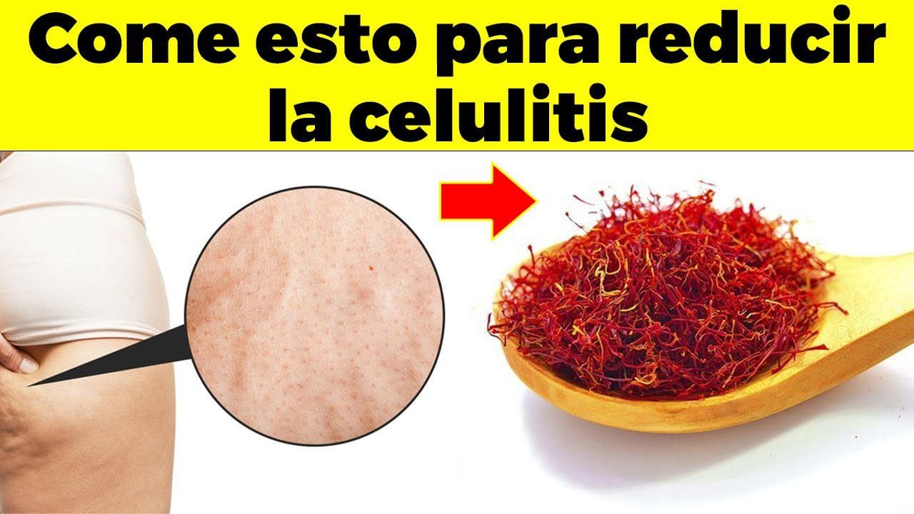 Alimentos-que-ayudan-a-combatir-la-celulitis - Sonajero.es Alimentos que ayudan a combatir la celulitis