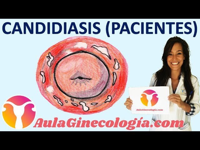 Como-prevenir-y-tratar-la-candidiasis-vaginal - Sonajero.es Cómo prevenir y tratar la candidiasis vaginal