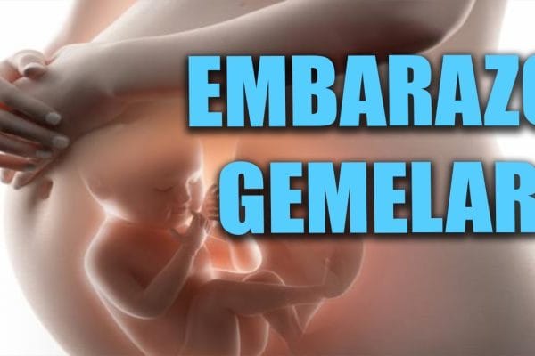 Todo lo que Necesitas Saber sobre el Embarazo Múltiple: Guía Completa para Futuras Mamás