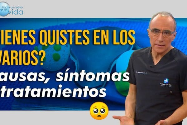 Cómo manejar los quistes ováricos
