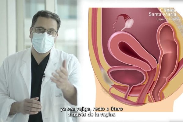Cómo prevenir y tratar el prolapso uterino