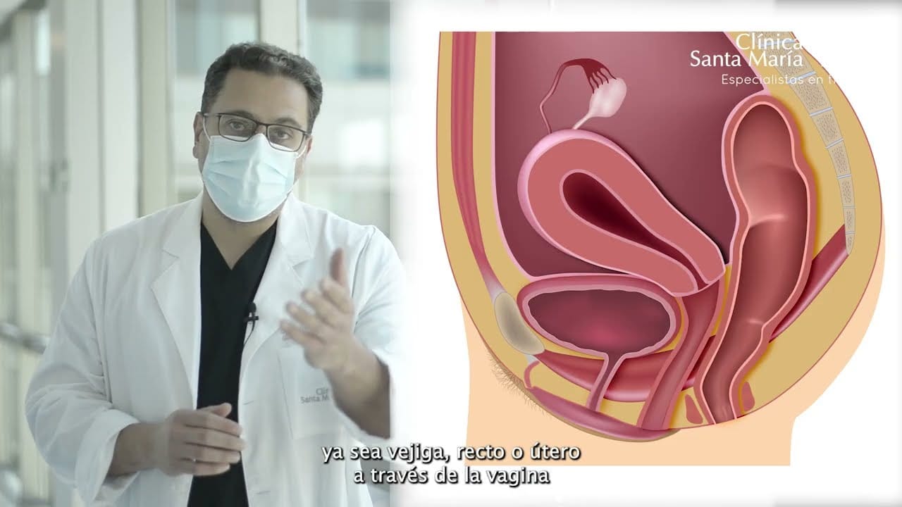 Como-prevenir-y-tratar-el-prolapso-uterino - Sonajero.es Cómo prevenir y tratar el prolapso uterino