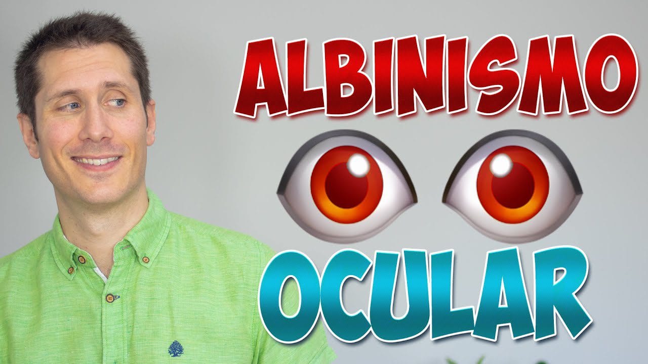 Conoce-Ojos-Albos - Sonajero.es Conoce Ojos Albos