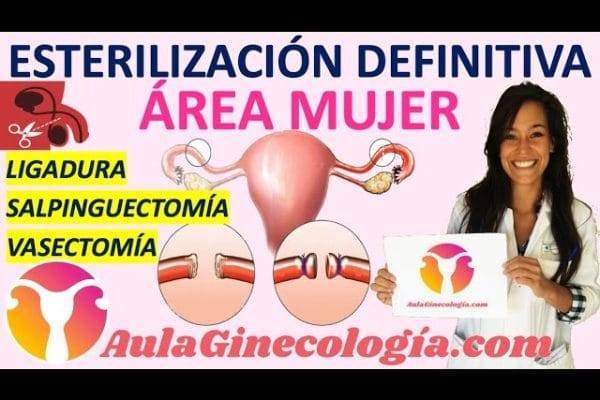 Todo lo que necesitas saber sobre la ligadura de trompas
