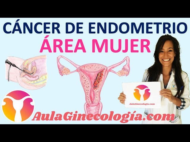 Como-identificar-y-tratar-el-cancer-de-endometrio - Sonajero.es Cómo identificar y tratar el cáncer de endometrio