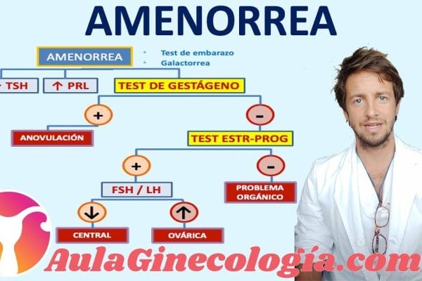 Cómo Manejar la Amenorrea Secundaria: Causas, Síntomas y Tratamientos Efectivos