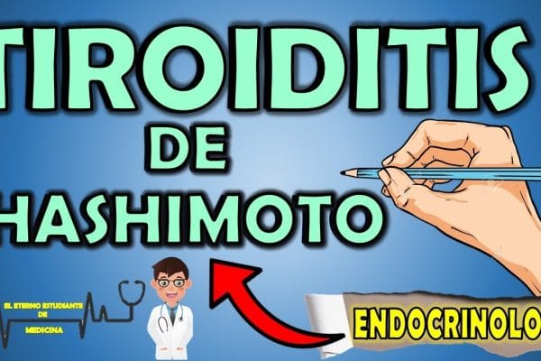 La Relación entre la Tiroiditis de Hashimoto y la Salud Femenina: Todo lo que Debes Saber