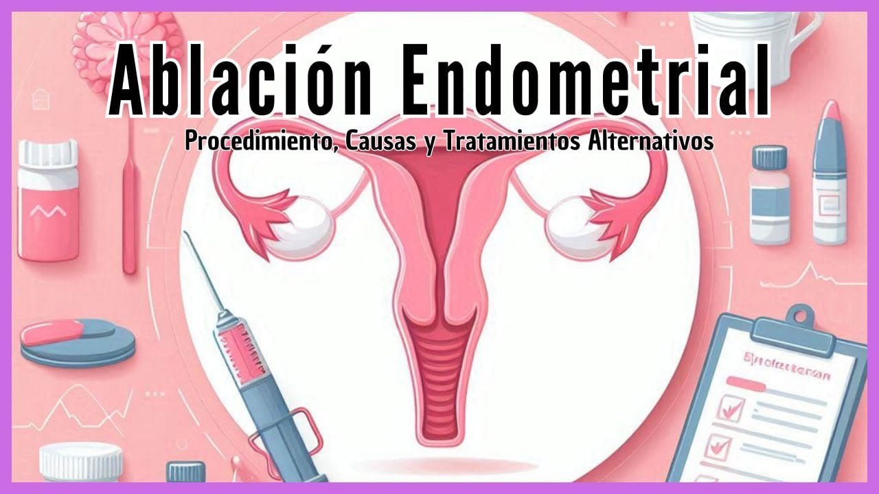 Todo-lo-que-necesitas-saber-sobre-la-ablacion-endometrial - Sonajero.es Todo lo que necesitas saber sobre la ablación endometrial
