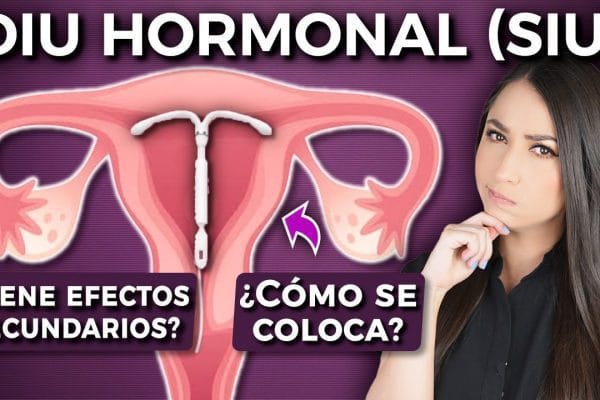 Todo lo que Necesitas Saber sobre la Colocación de DIU: Guía Completa y Consejos Prácticos