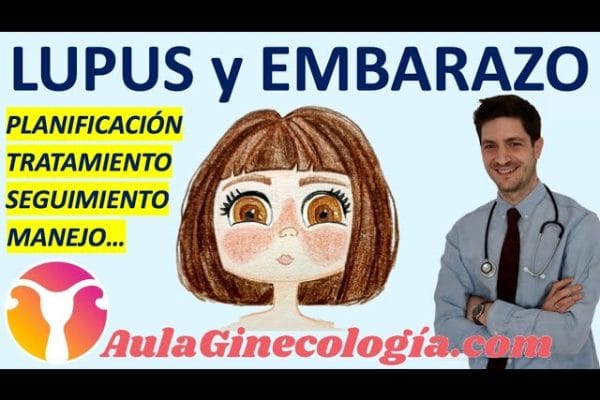 Todo sobre el seguimiento del embarazo con lupus: Guía completa y consejos esenciales