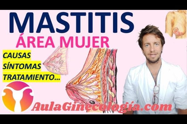 Todo sobre la Mastitis: Causas, Síntomas y Tratamientos Efectivos