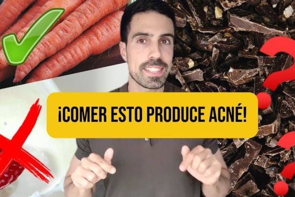 Los Mejores Alimentos para una Piel Libre de Acné: Guía Completa para una Piel Saludable