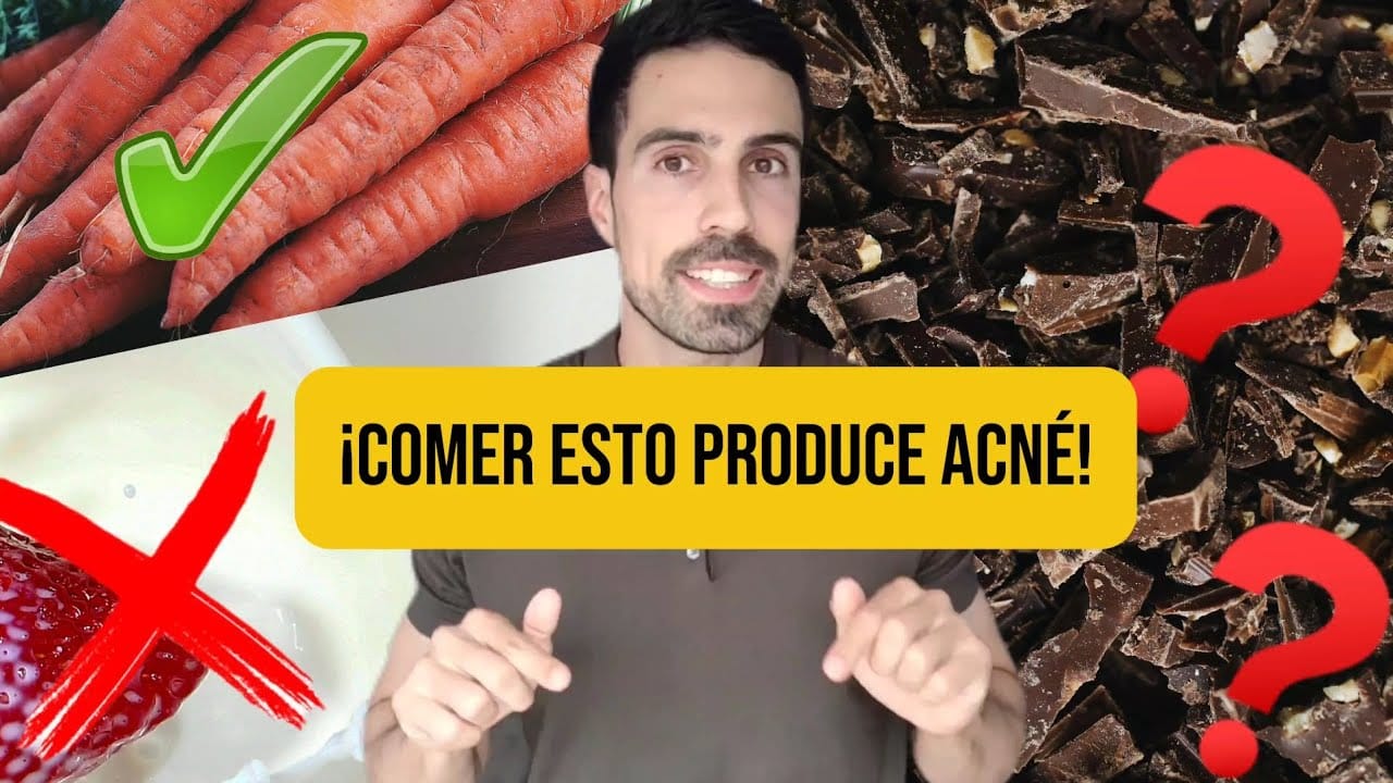 Alimentos-para-una-piel-libre-de-acne - Sonajero.es Alimentos para una piel libre de acné