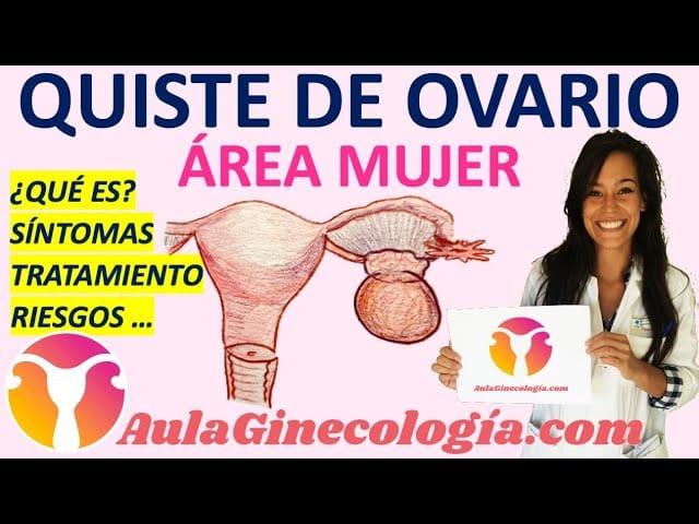 Todo lo que necesitas saber sobre la extirpación de quistes ováricos