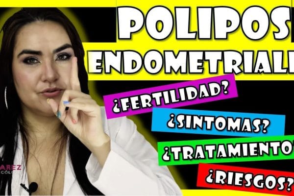 Todo lo que Necesitas Saber sobre la Extracción de Pólipos Endometriales: Guía Completa y Consejos