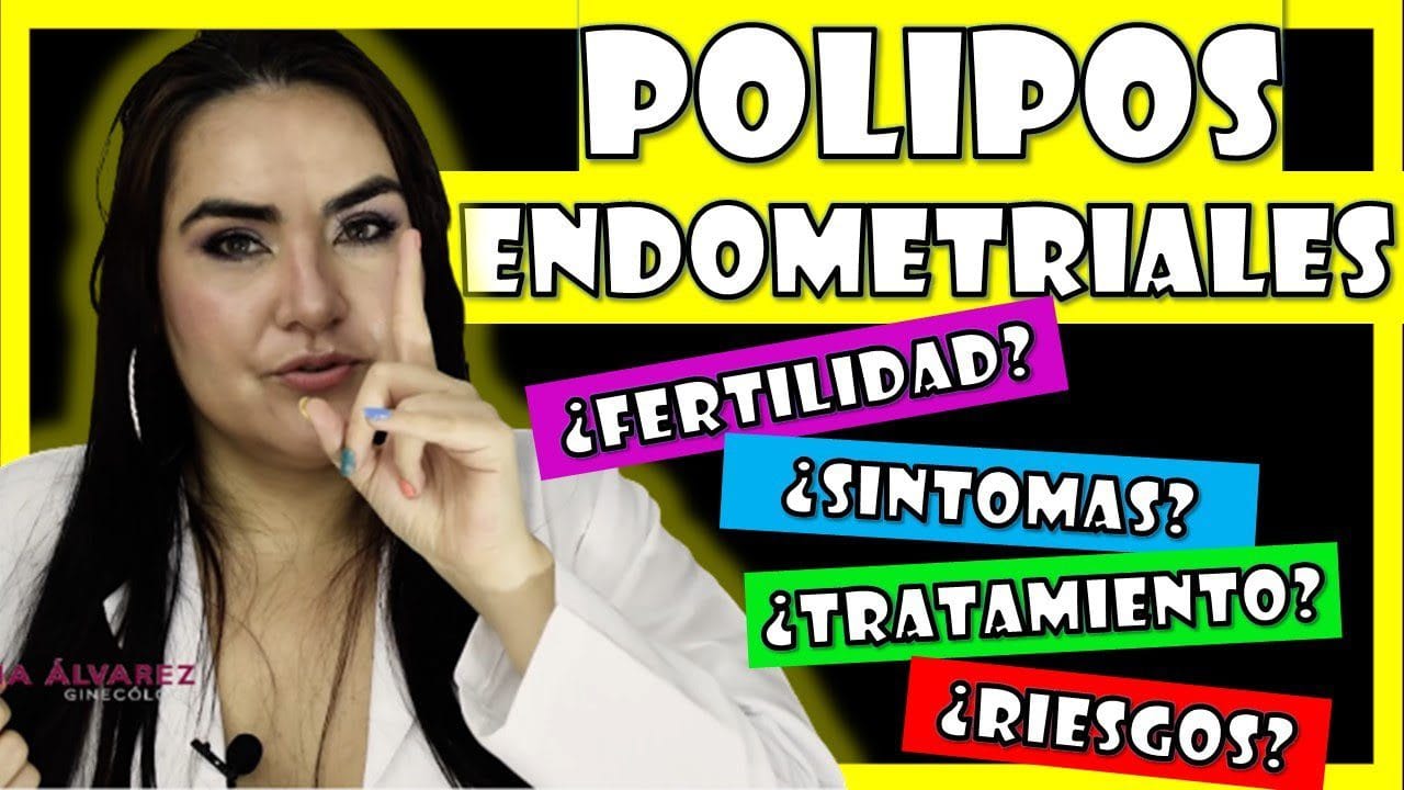 Todo-lo-que-necesitas-saber-sobre-la-extraccion-de-polipos-endometriales - Sonajero.es Todo lo que necesitas saber sobre la extracción de pólipos endometriales