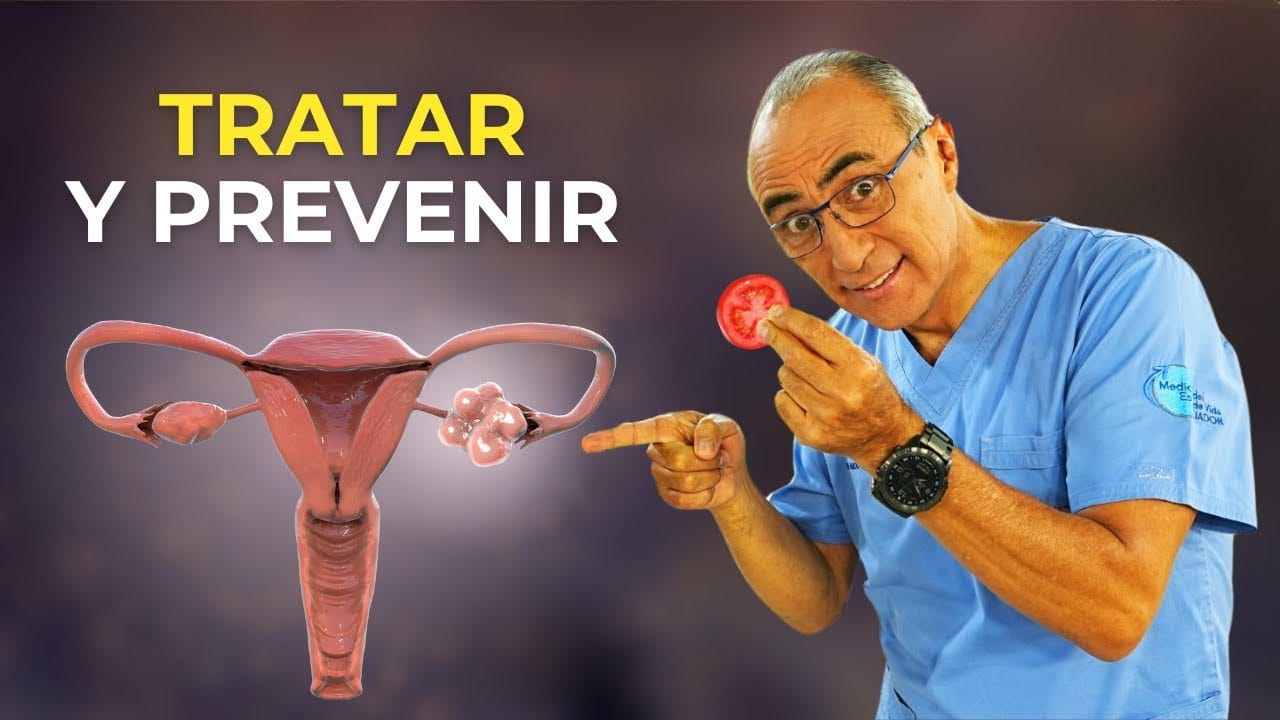 Como-manejar-el-sindrome-del-ovario-poliquistico-con-la-dieta - Sonajero.es Cómo manejar el síndrome del ovario poliquístico con la dieta