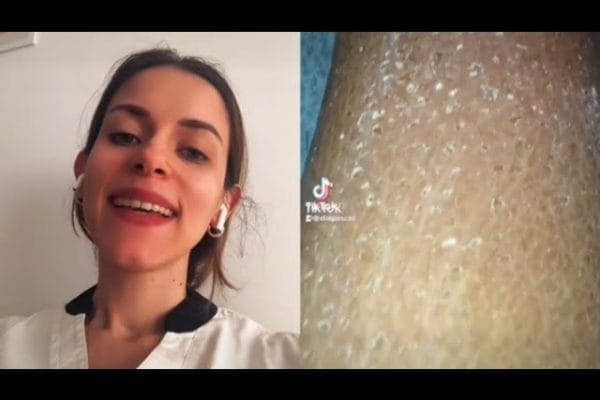 Guía Completa de Dieta para Mujeres: Soluciones Nutricionales para la Piel Seca y Deshidratada
