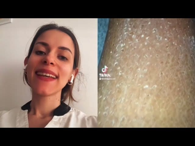 Dieta-para-mujeres-con-problemas-de-piel-seca-y-deshidratada - Sonajero.es Dieta para mujeres con problemas de piel seca y deshidratada